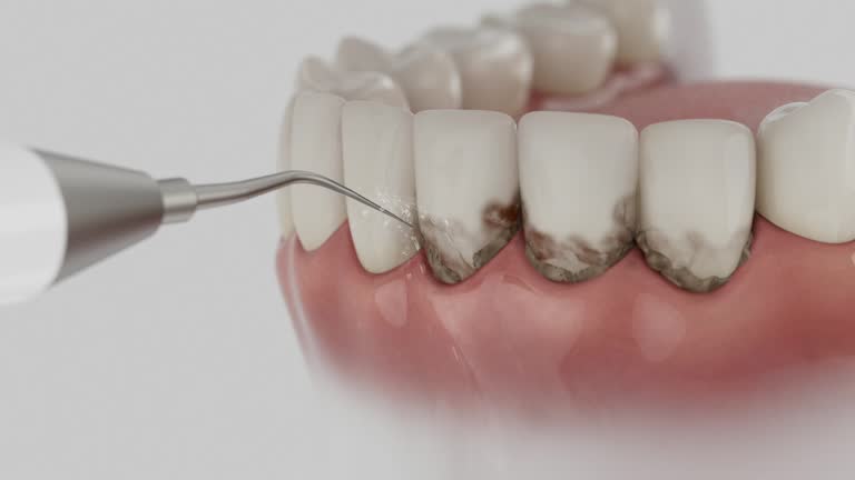 Trusted Wisdom Tooth Removal service in Gorman, NC - Dentist Open Now